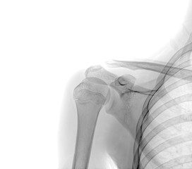 Durham Personal Injury Lawyer Durham
